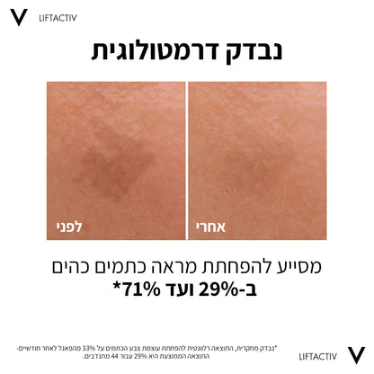 ליפטאקטיב ספיישליסט סרום B3 30 מ"ל - וישי