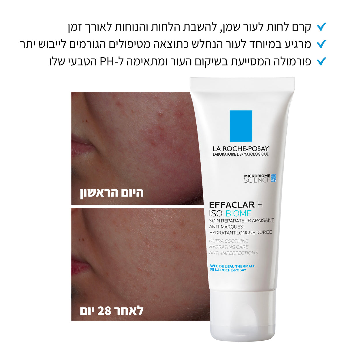 קרם לחות 'אפקלאר H' לעור פנים שמן הנוטה לפצעונים ואדמומיות 40 מ"ל - לה רוש פוזה