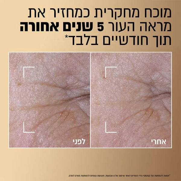 age pefect dou serum loreal paris
