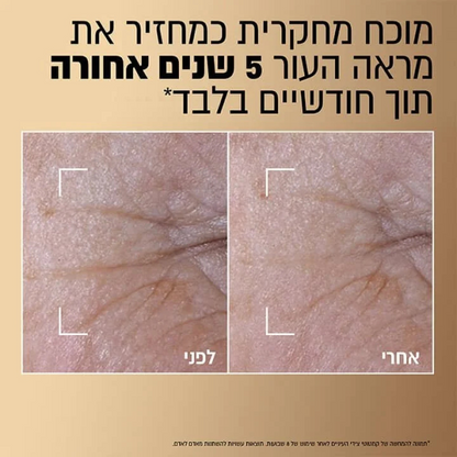 age pefect dou serum loreal paris