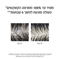 דרקוס שמפו נגד קשקשים לשיער יבש 390 מ"ל - וישי