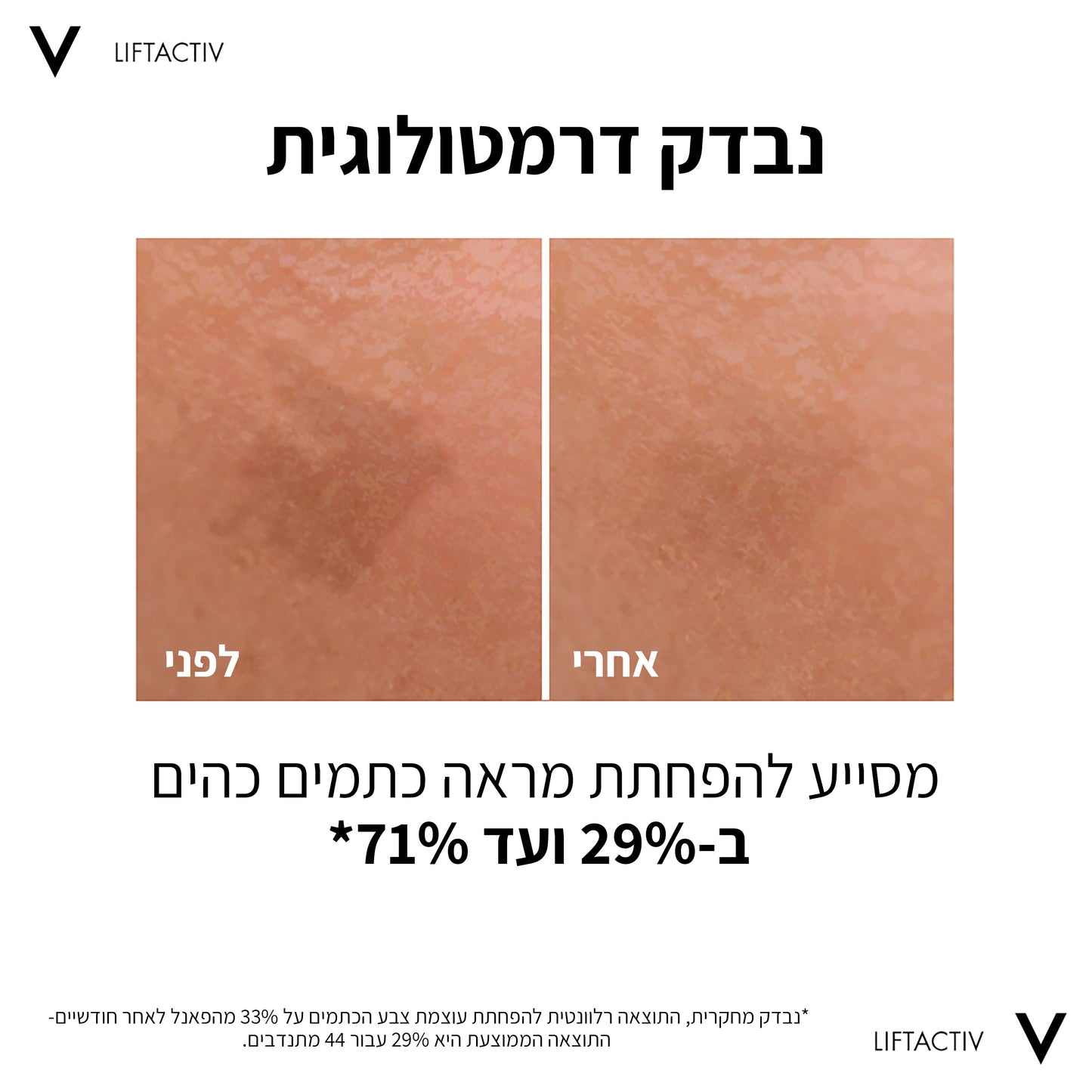 ליפטאקטיב ספיישליסט סרום B3 30 מ"ל - וישי