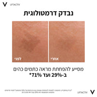 ליפטאקטיב ספיישליסט סרום B3 30 מ"ל - וישי