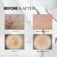 VT Microneedling Serum Reedle Shot 100