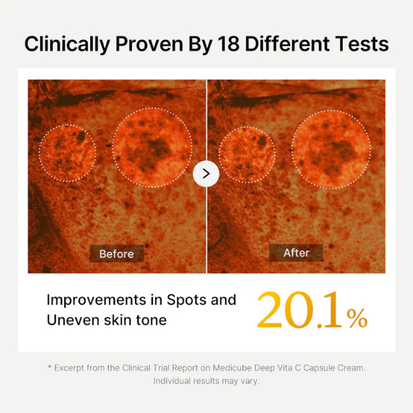 קרם ויטמין סי medicube