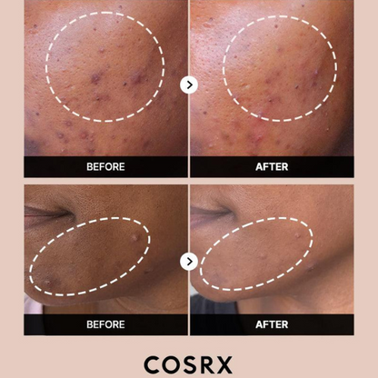 סרום אלפא ארבוטין 2% לטיפול בפיגמנטציה וצלקות בעור הפנים 50 מ"ל - COSRX