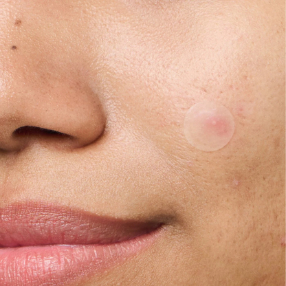 מדבקות 'מייטי פאצ' שקופות לטיפול בפצעונים דקות במיוחד לשעות היום 24 יח' - Hero