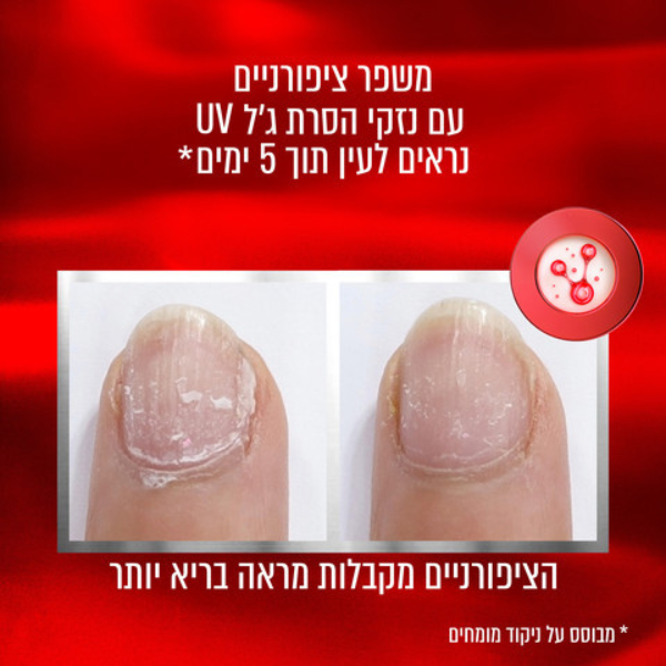 לק משקם ציפורניים 'טו דה רסקיו' - אססי