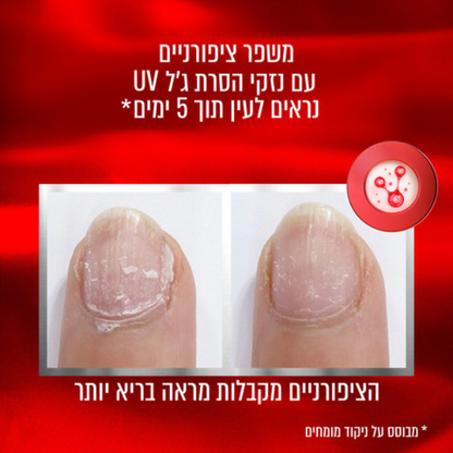 לק משקם ציפורניים 'טו דה רסקיו' - אססי