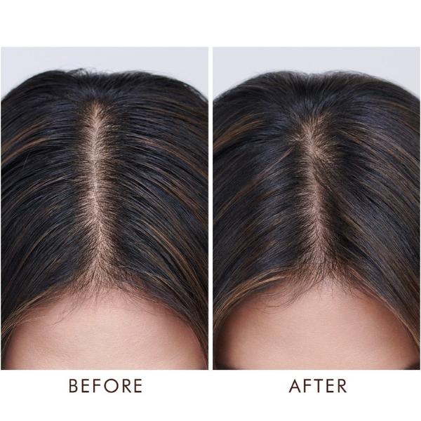 Moroccanoil Oily Scalp Treatment