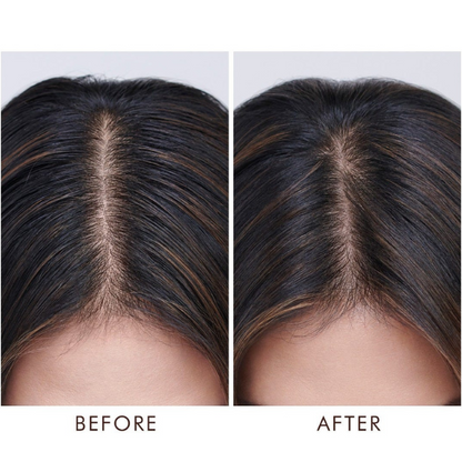Moroccanoil Oily Scalp Treatment