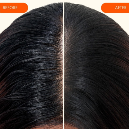 שמפו יבש אולטרה Perk Up Ultra לאיזון השומניות בשיער ובקרקפת 250 מ"ל - אמיקה