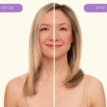 מרכך big hit המעניק נפח ומראה מלא חיים לשיער דק 275 מ"ל - אמיקה