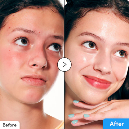 סרום היילטואין להענקת לחות וסיוע בהבהרת עור הפנים 30 מ"ל - EQQUALBERRY