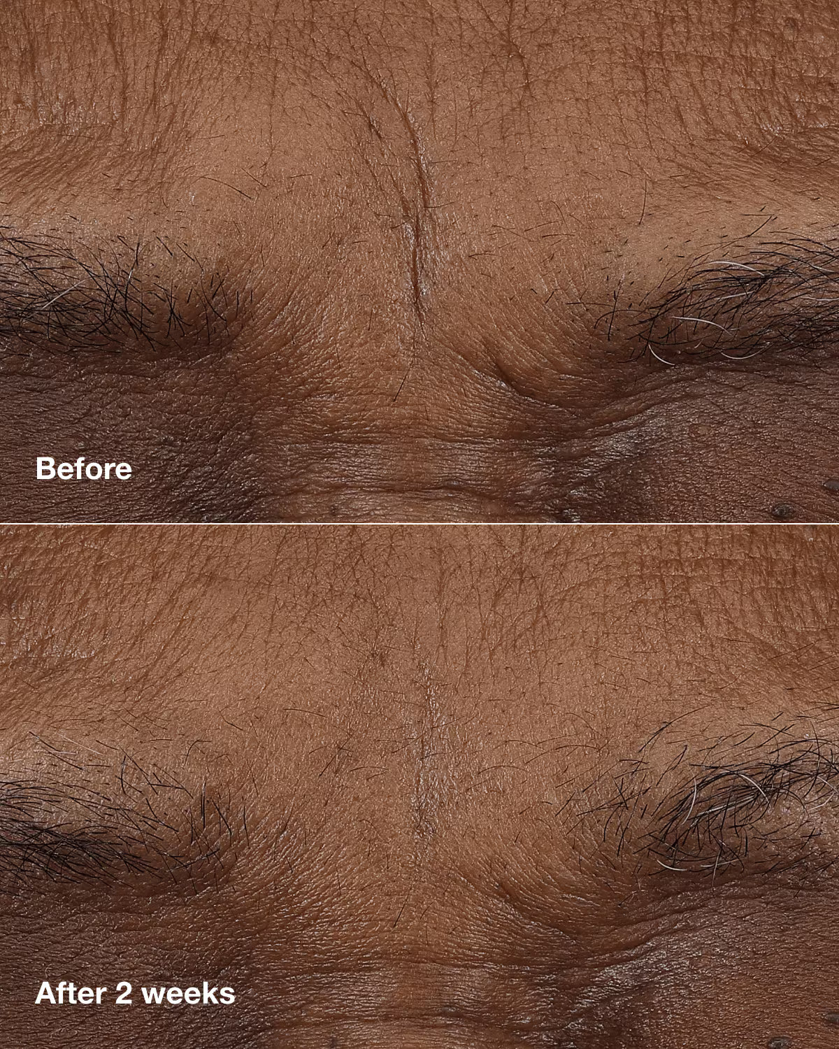 Clinique Smart Clinical Repair Retinoid Balm